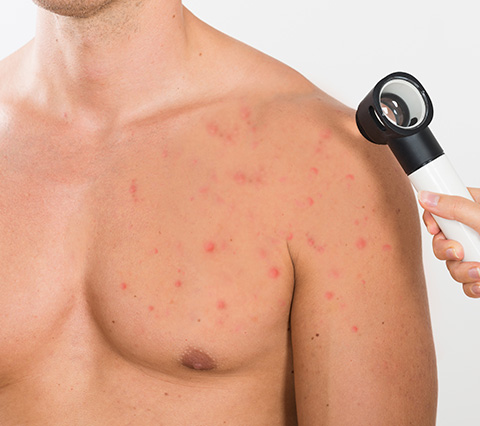 Cuidamos tu piel con nuestros tratamientos dermatológicos en Bogotá Hombre en consulta de tratamientos dermatológicos en Bogotá