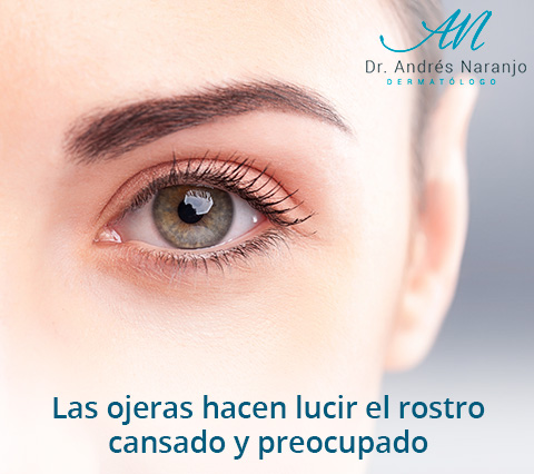 Tenemos los mejores métodos de tratamiento de ojeras en Bogotá Mujer en tratamiento de ojeras en Bogotá